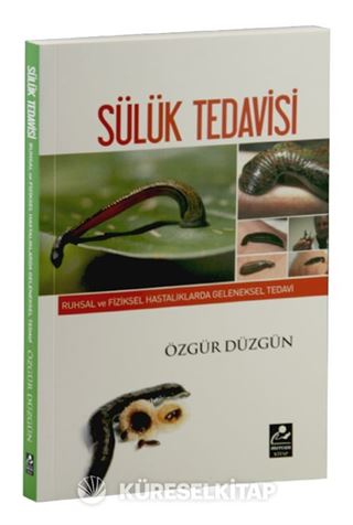 Sülük Tedavisi