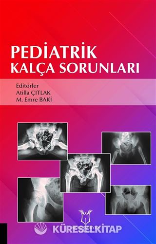 Pediatrik Kalça Sorunları