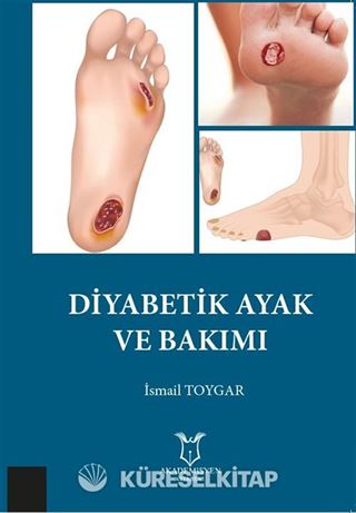 Diyabetik Ayak ve Bakımı
