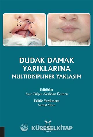 Dudak Damak Yarıklarına Multidisipliner Yaklaşım