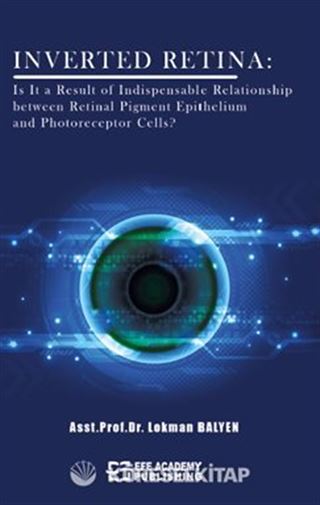 Inverted Retina: Is It A Result Of Indispensable Relationship Between Retinal Pigment Epithelium And Photoreceptor Cells?