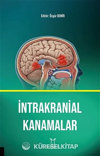 İntrakranial Kanamalar